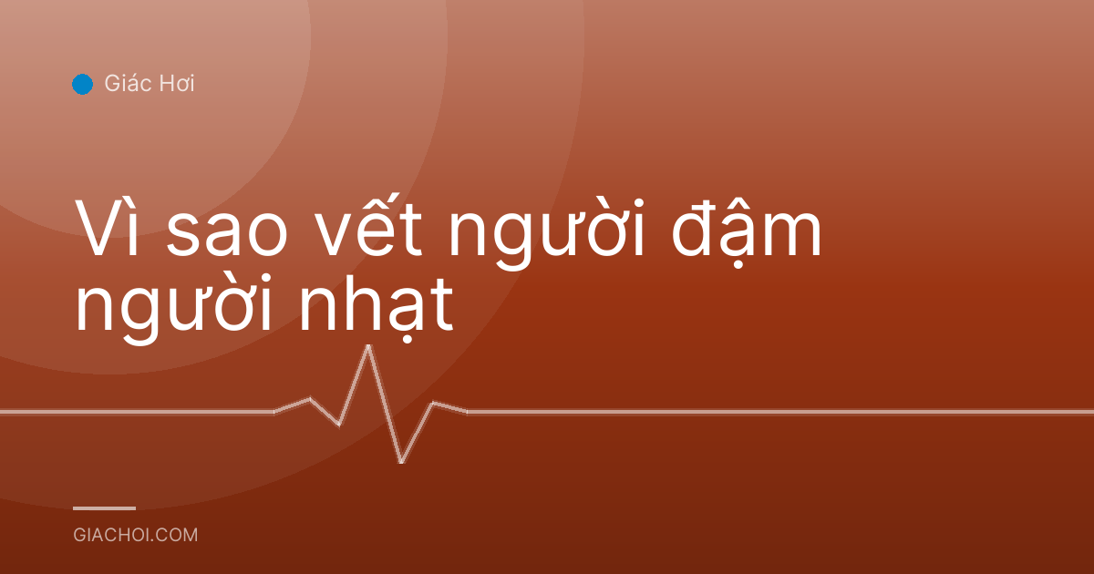 Vì sao vết người đậm người nhạt