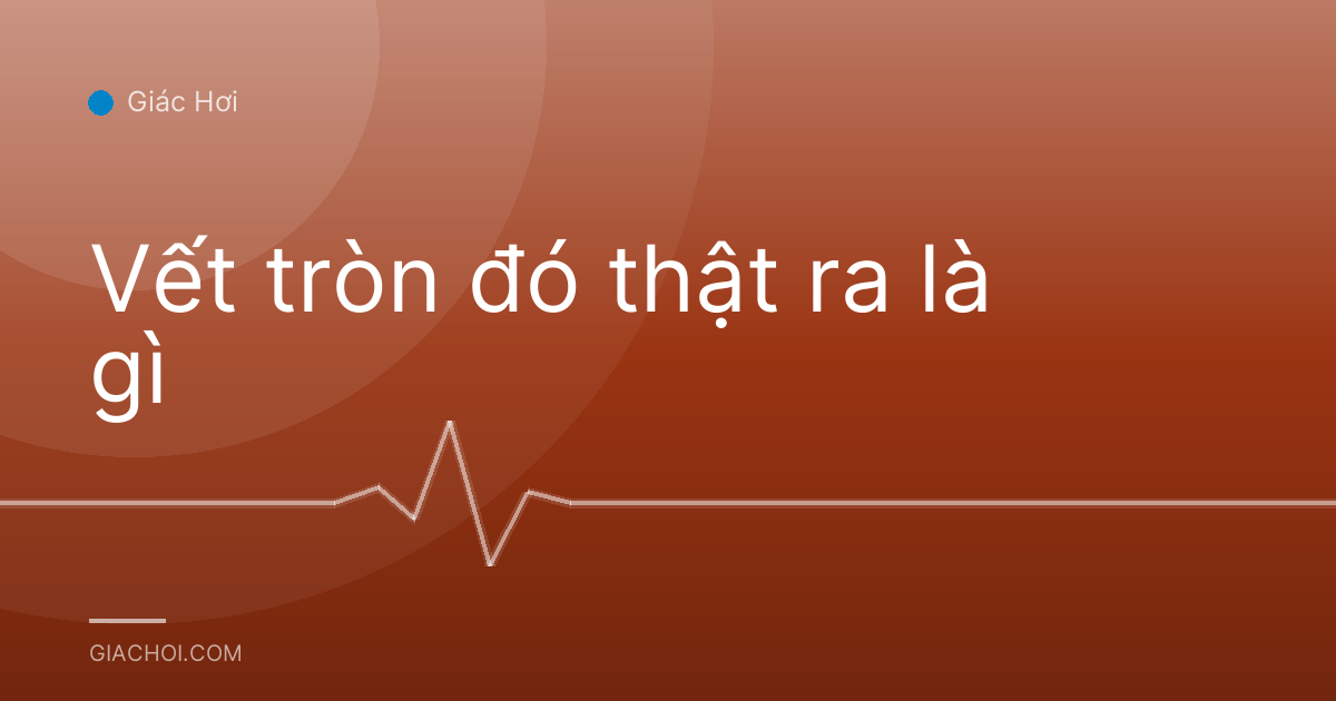 Vết tròn đó thật ra là gì